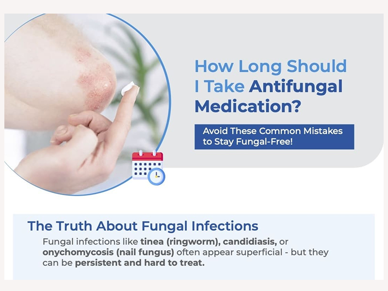 How long should I take Antifungal Medication Image
